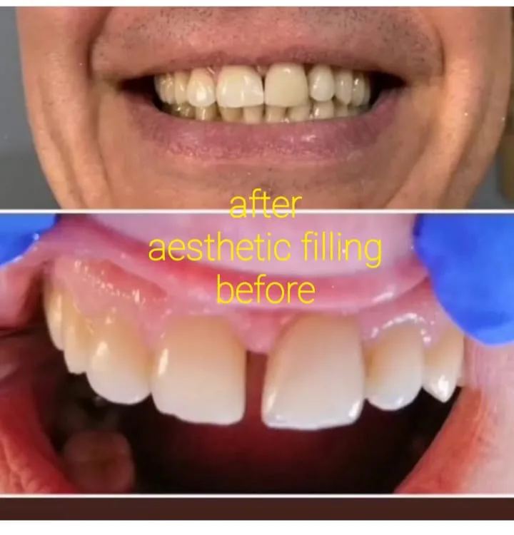 Alanya HEALTHY TEETH Dental Aesthetic — Geneeskunde in Alanya: Online bestellen, prijzen en beoordelingen