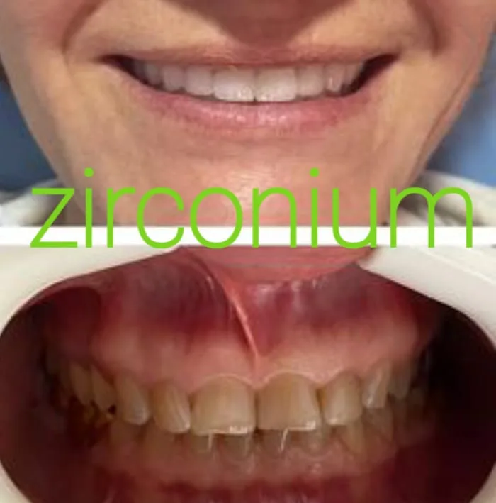 Alanya HEALTHY TEETH Dental Aesthetic — Geneeskunde in Alanya: Online bestellen, prijzen en beoordelingen