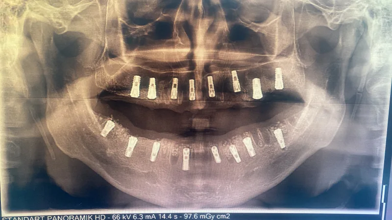 Alanya HEALTHY TEETH Dental Aesthetic — Geneeskunde in Alanya: Online bestellen, prijzen en beoordelingen