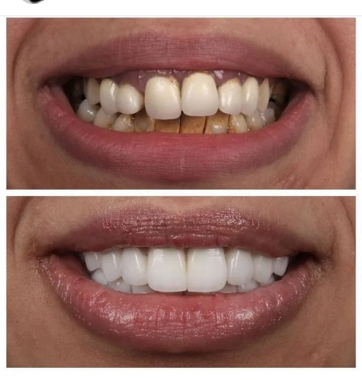 Alanya HEALTHY TEETH Dental Aesthetic — Geneeskunde in Alanya: Online bestellen, prijzen en beoordelingen