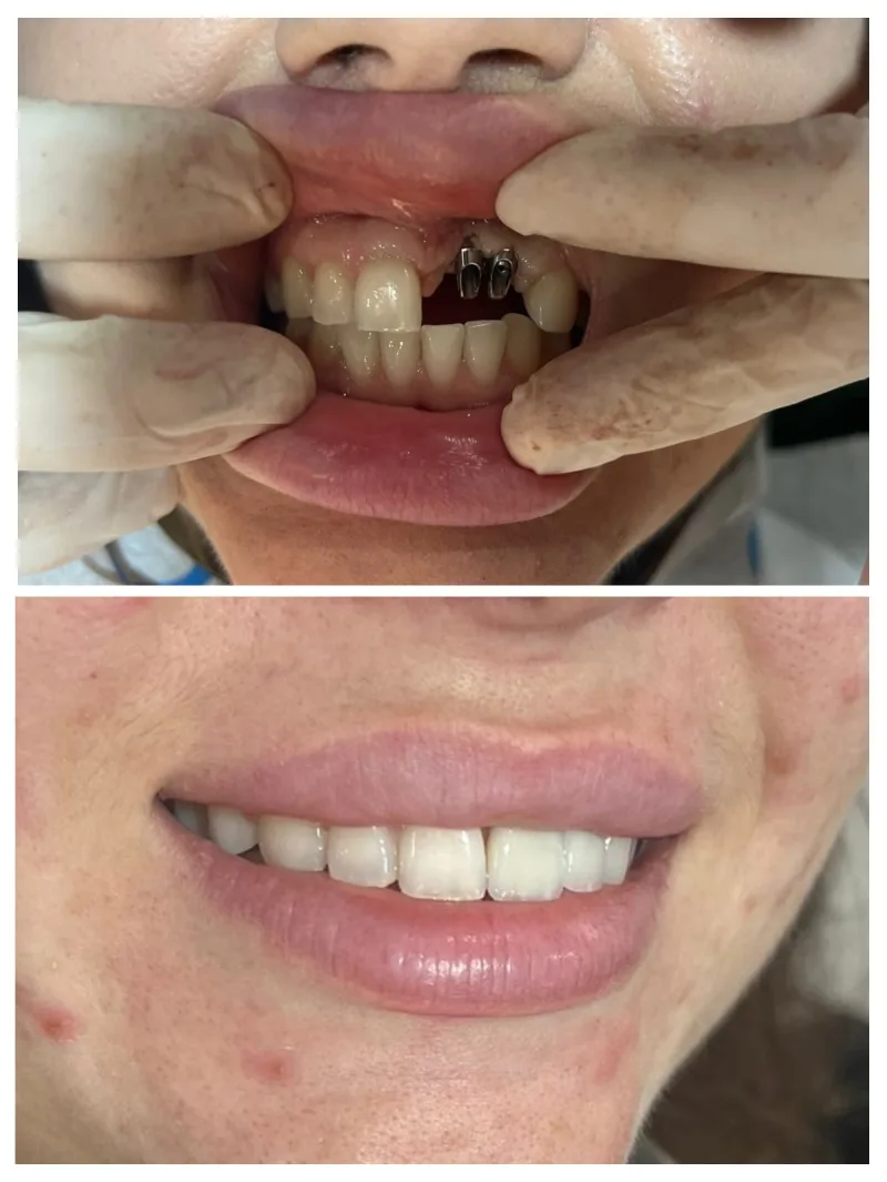 Alanya HEALTHY TEETH Dental Aesthetic — Geneeskunde in Alanya: Online bestellen, prijzen en beoordelingen