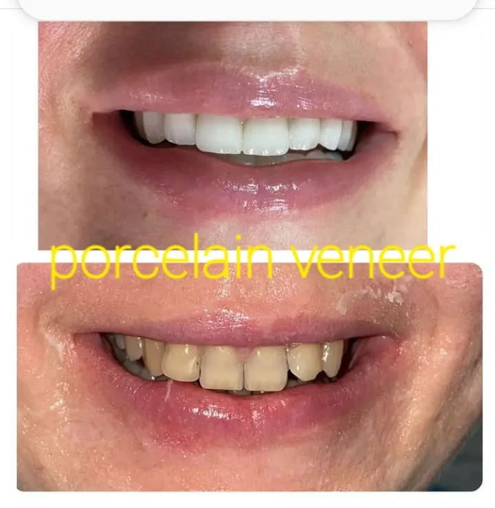 Alanya HEALTHY TEETH Dental Aesthetic — Geneeskunde in Alanya: Online bestellen, prijzen en beoordelingen